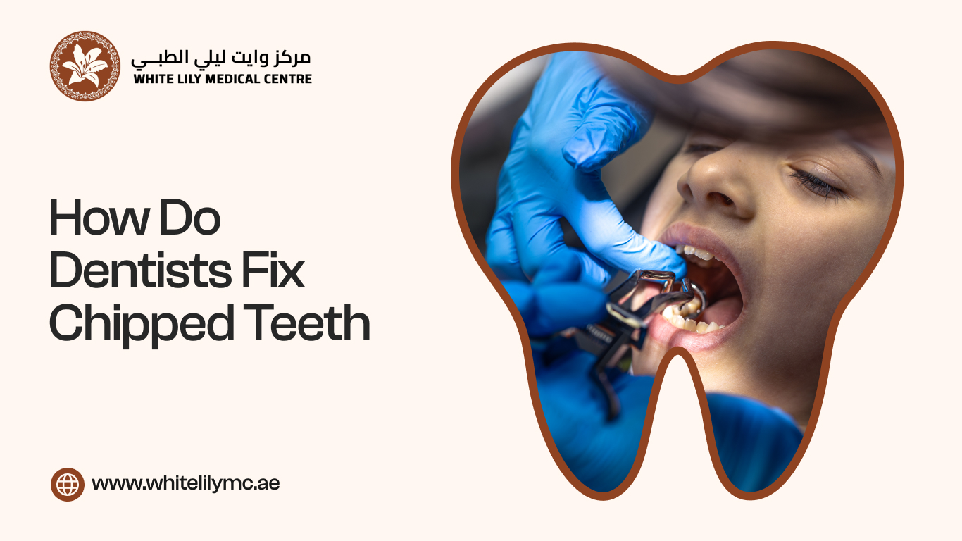 How Do Dentists Fix Chipped Teeth