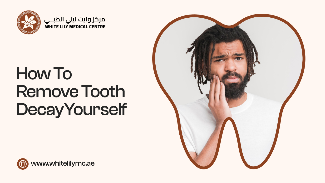 Remove Tooth Decay Yourself