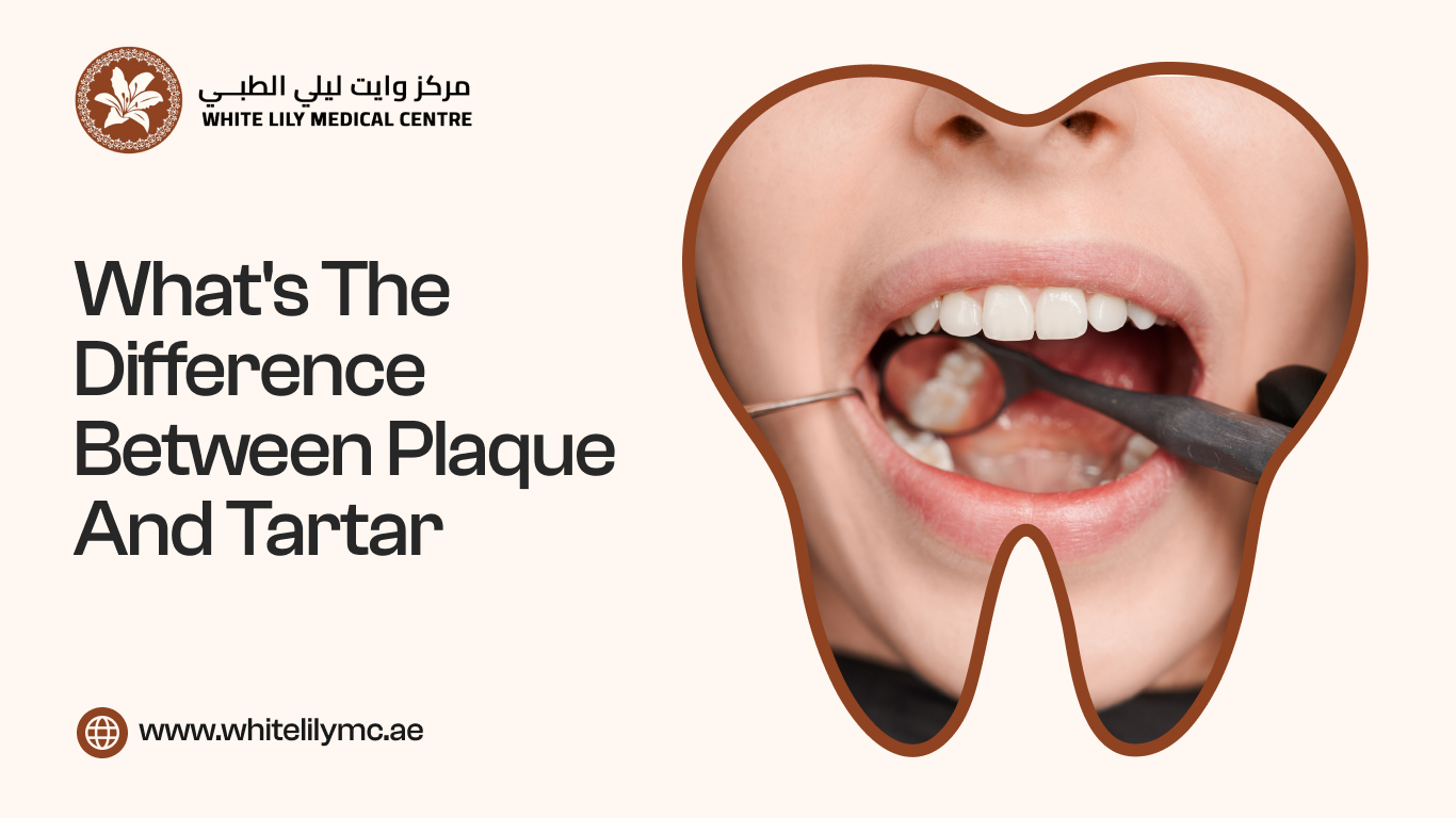 What's the Difference Between Plaque and Tartar