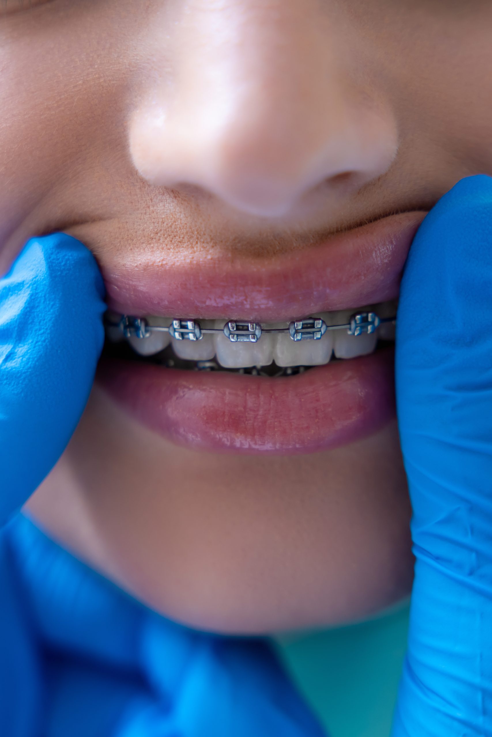 تقويم اسنان في ابوظبي