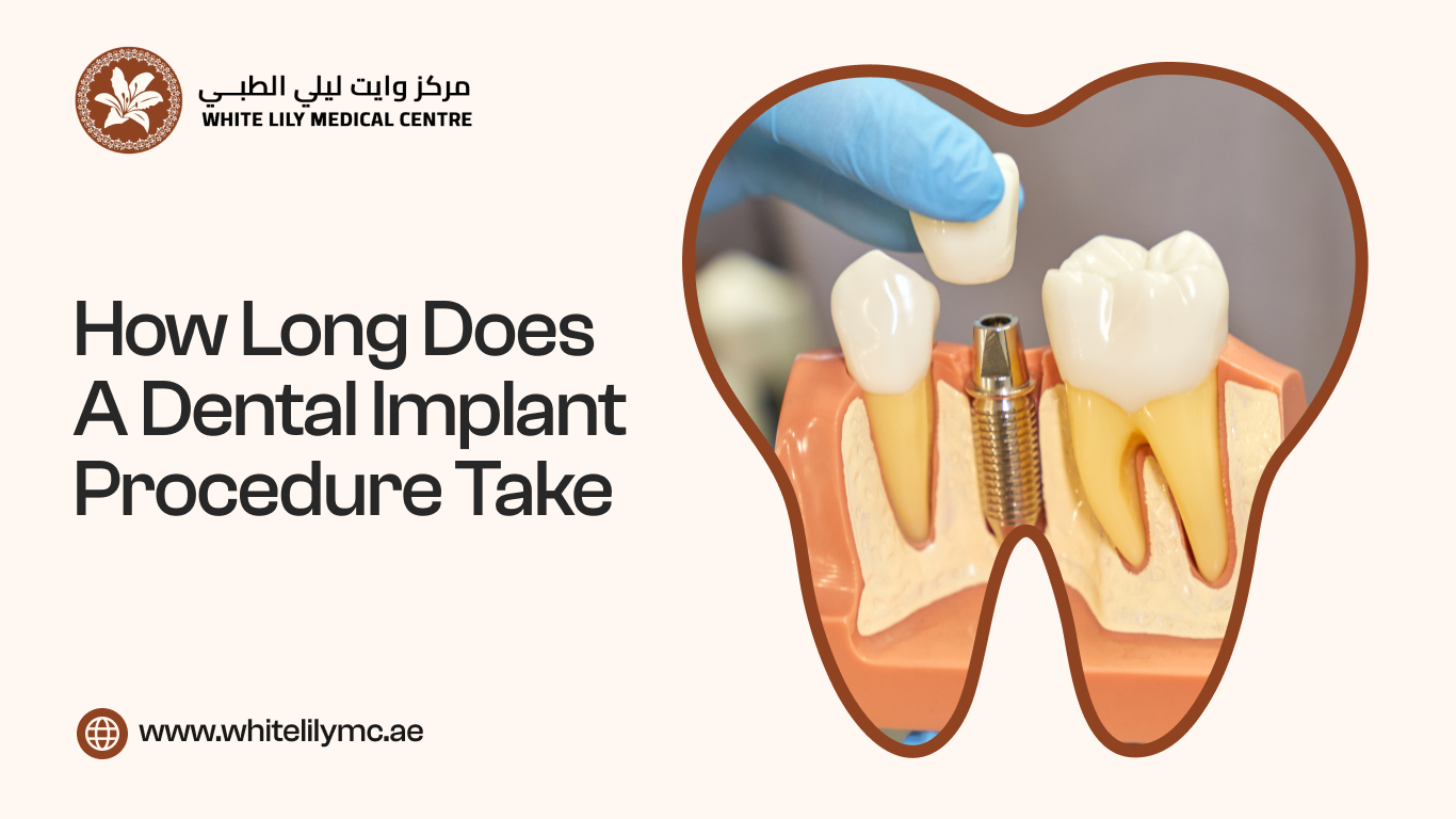 How Long Does a Dental Implant Procedure Take