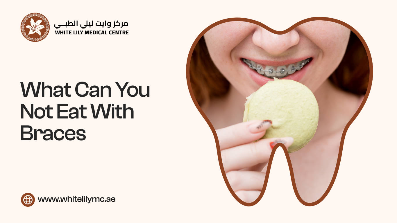 What Can You Not Eat With Braces