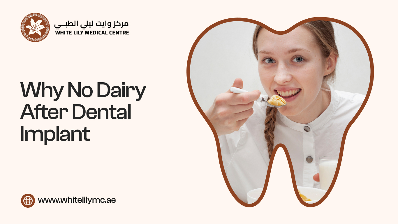 Why No Dairy After Dental Implant